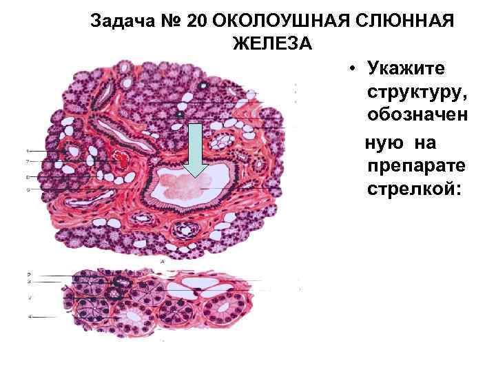 Задача № 20 ОКОЛОУШНАЯ СЛЮННАЯ ЖЕЛЕЗА • Укажите структуру, обозначен ную на препарате стрелкой: