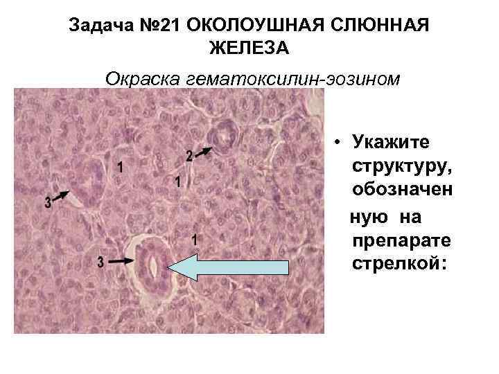 Задача № 21 ОКОЛОУШНАЯ СЛЮННАЯ ЖЕЛЕЗА Окраска гематоксилин-эозином • Укажите структуру, обозначен ную на
