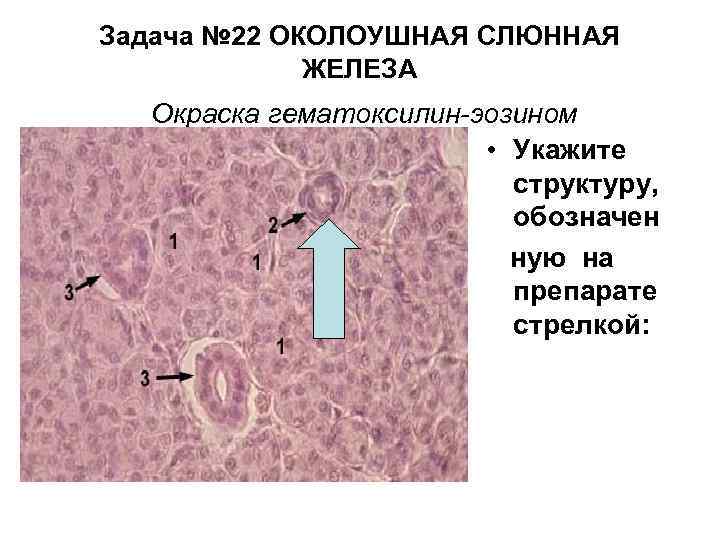 Задача № 22 ОКОЛОУШНАЯ СЛЮННАЯ ЖЕЛЕЗА Окраска гематоксилин-эозином • Укажите структуру, обозначен ную на