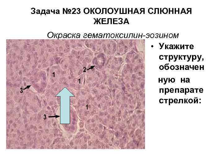 Задача № 23 ОКОЛОУШНАЯ СЛЮННАЯ ЖЕЛЕЗА Окраска гематоксилин-эозином • Укажите структуру, обозначен ную на