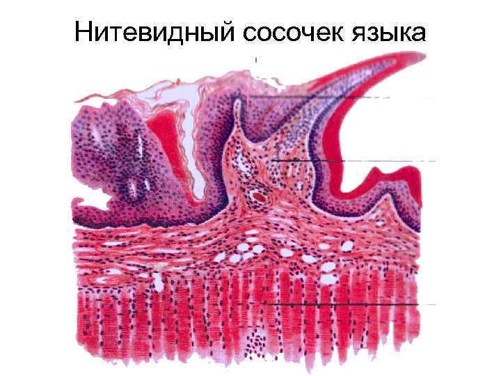 Нитевидные сосочки фото