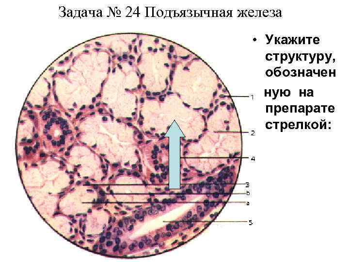 Задача № 24 Подъязычная железа • Укажите структуру, обозначен ную на препарате стрелкой: 