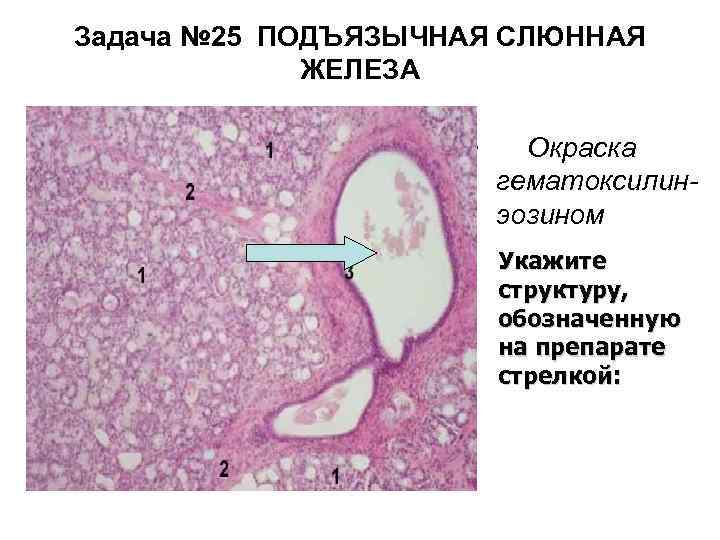 Задача № 25 ПОДЪЯЗЫЧНАЯ СЛЮННАЯ ЖЕЛЕЗА • Окраска гематоксилинэозином Укажите структуру, обозначенную на препарате