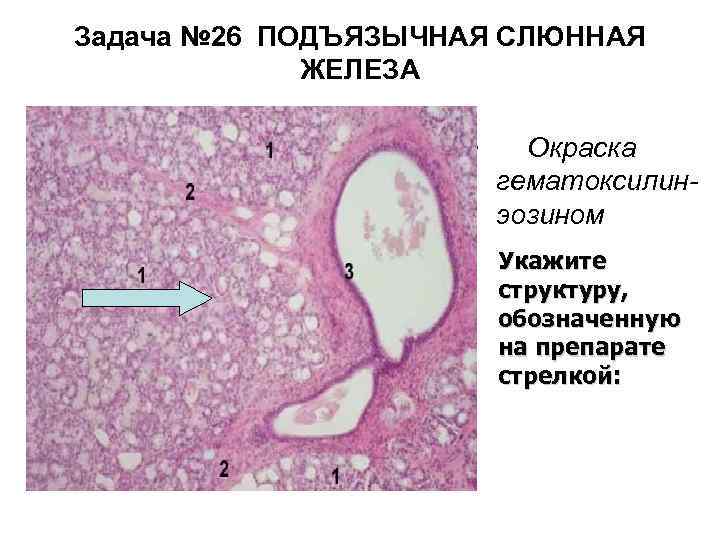 Задача № 26 ПОДЪЯЗЫЧНАЯ СЛЮННАЯ ЖЕЛЕЗА • Окраска гематоксилинэозином Укажите структуру, обозначенную на препарате