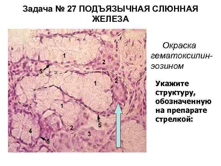 Задача № 27 ПОДЪЯЗЫЧНАЯ СЛЮННАЯ ЖЕЛЕЗА • Окраска гематоксилинэозином Укажите структуру, обозначенную на препарате