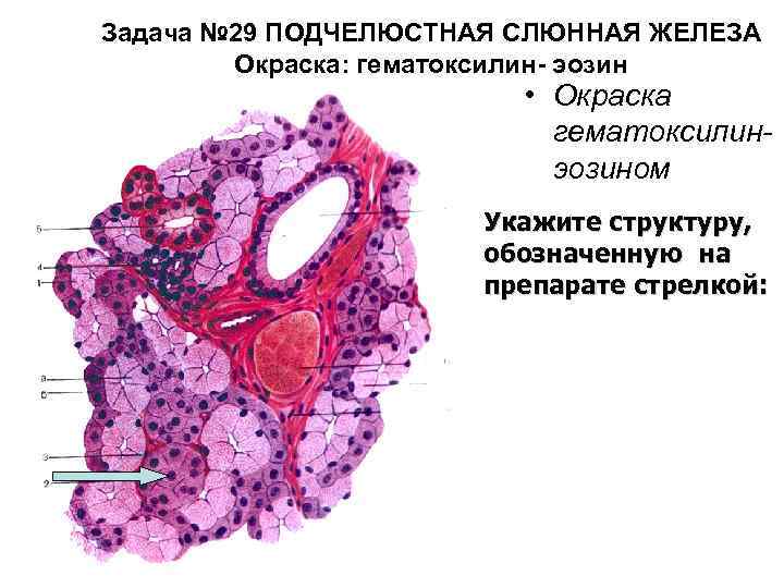 Задача № 29 ПОДЧЕЛЮСТНАЯ СЛЮННАЯ ЖЕЛЕЗА Окраска: гематоксилин- эозин • Окраска гематоксилинэозином Укажите структуру,