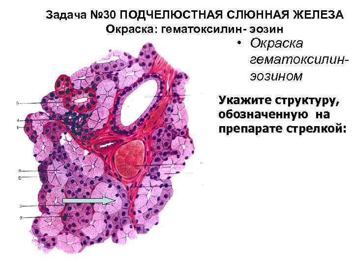 Задача № 30 ПОДЧЕЛЮСТНАЯ СЛЮННАЯ ЖЕЛЕЗА Окраска: гематоксилин- эозин • Окраска гематоксилинэозином Укажите структуру,