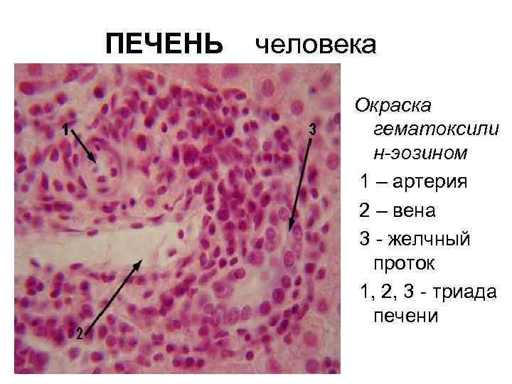 ПЕЧЕНЬ человека Окраска гематоксили н-эозином 1 – артерия 2 – вена 3 - желчный
