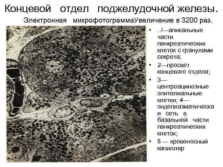 Электронная схема железа