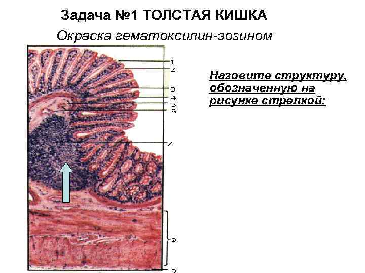 Толстая кишка рисунок