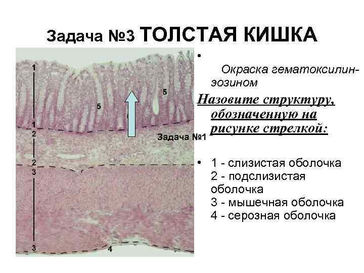 Задача № 3 ТОЛСТАЯ • КИШКА Окраска гематоксилинэозином Назовите структуру, обозначенную на рисунке стрелкой: