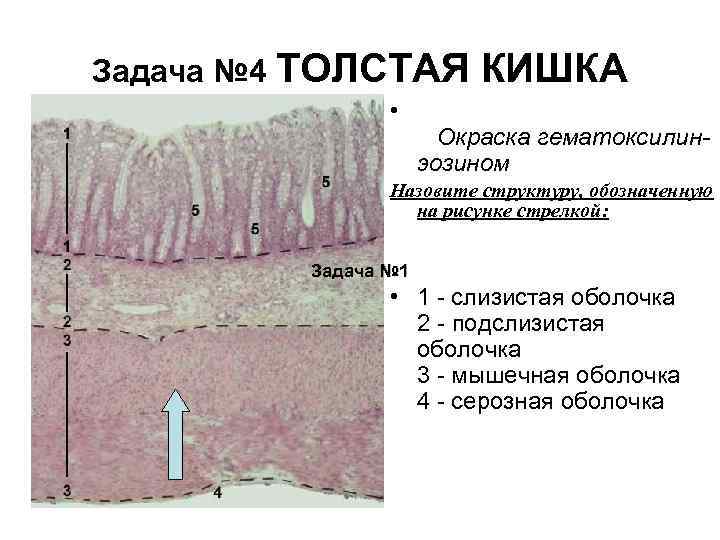 Задача № 4 ТОЛСТАЯ • КИШКА Окраска гематоксилинэозином Назовите структуру, обозначенную на рисунке стрелкой: