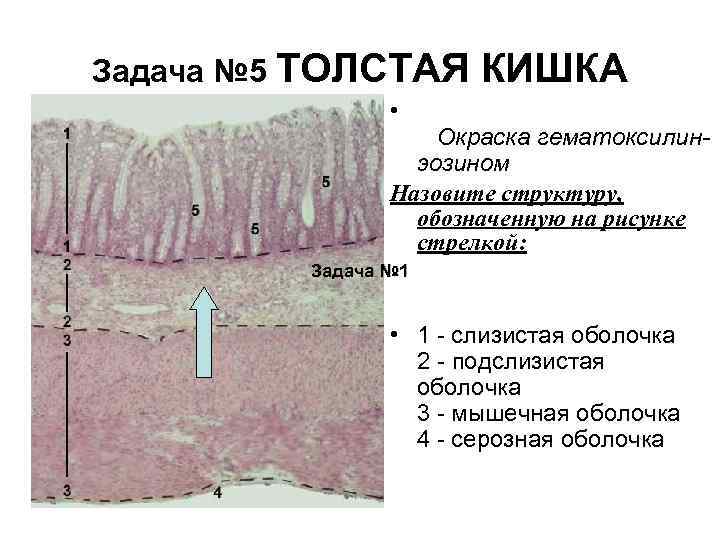 Что находится в зонах обозначенных на рисунке фрагмента тонкой кишки