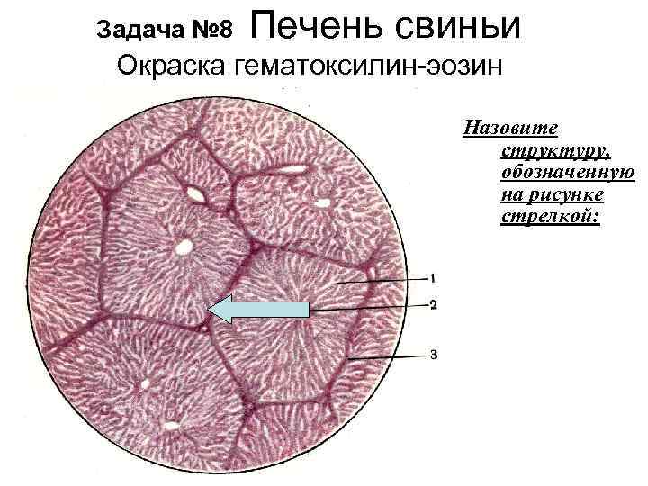 Задача № 8 Печень свиньи Окраска гематоксилин-эозин Назовите структуру, обозначенную на рисунке стрелкой: 