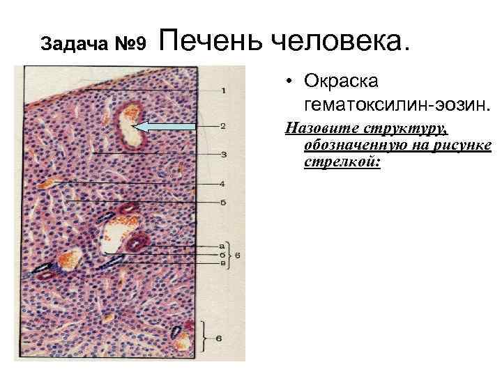 Задача № 9 Печень человека. • Окраска гематоксилин-эозин. Назовите структуру, обозначенную на рисунке стрелкой: