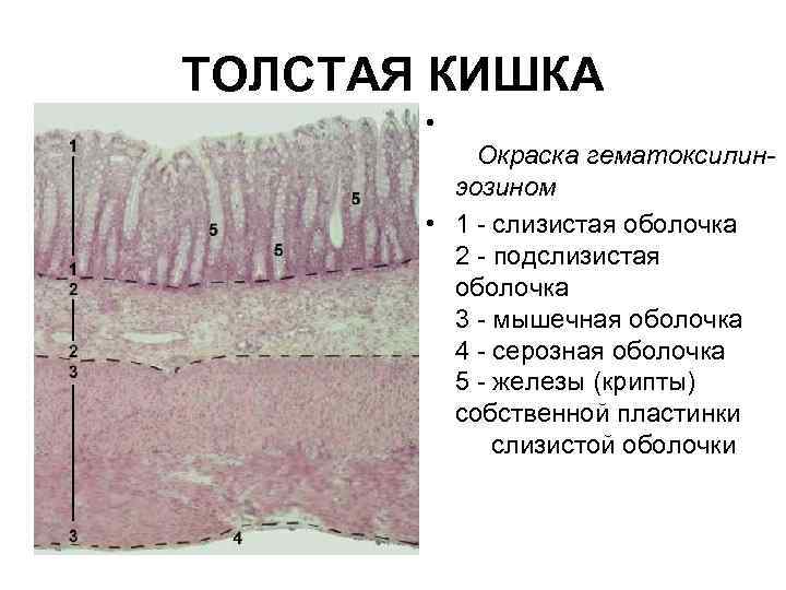ТОЛСТАЯ КИШКА • Окраска гематоксилинэозином • 1 - слизистая оболочка 2 - подслизистая оболочка