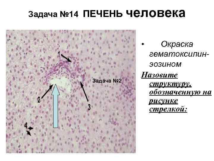 Задача № 14 ПЕЧЕНЬ Задача № 2 человека • Окраска гематоксилинэозином Назовите структуру, обозначенную