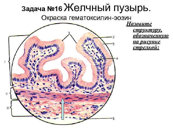 Задача № 16 Желчный пузырь. Окраска гематоксилин-эозин Назовите структуру, обозначенную на рисунке стрелкой: 