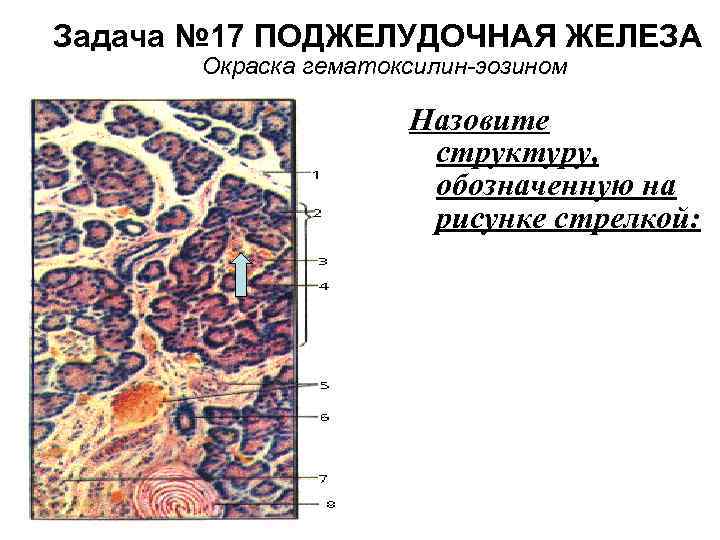 Задача № 17 ПОДЖЕЛУДОЧНАЯ ЖЕЛЕЗА Окраска гематоксилин-эозином Назовите структуру, обозначенную на рисунке стрелкой: 