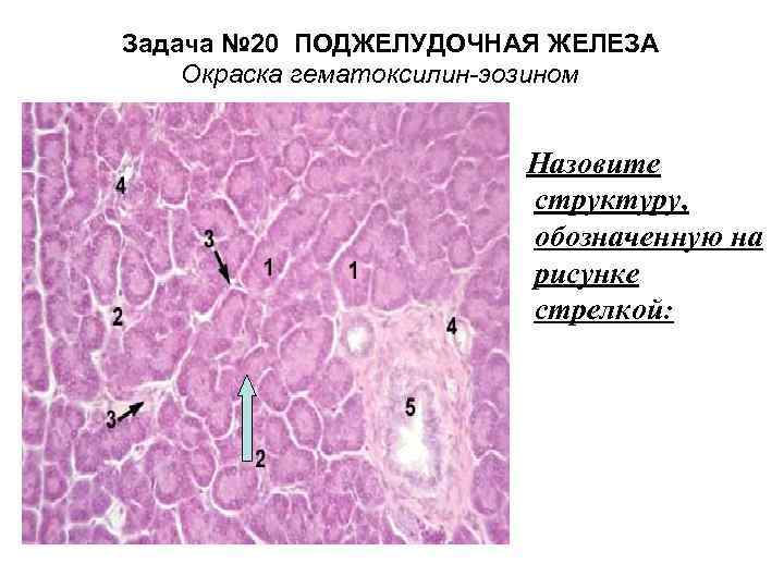 Сальная железа на рисунке