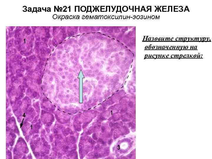 Задача № 21 ПОДЖЕЛУДОЧНАЯ ЖЕЛЕЗА Окраска гематоксилин-эозином Назовите структуру, обозначенную на рисунке стрелкой: 