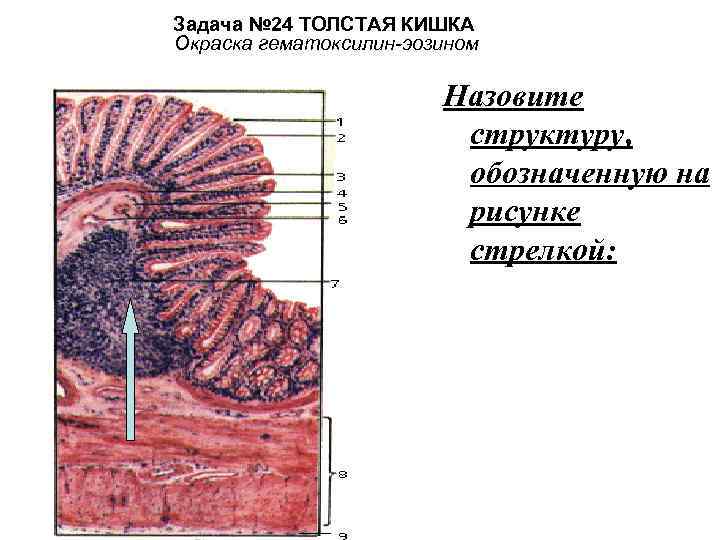 Задача № 24 ТОЛСТАЯ КИШКА Окраска гематоксилин-эозином Назовите структуру, обозначенную на рисунке стрелкой: 