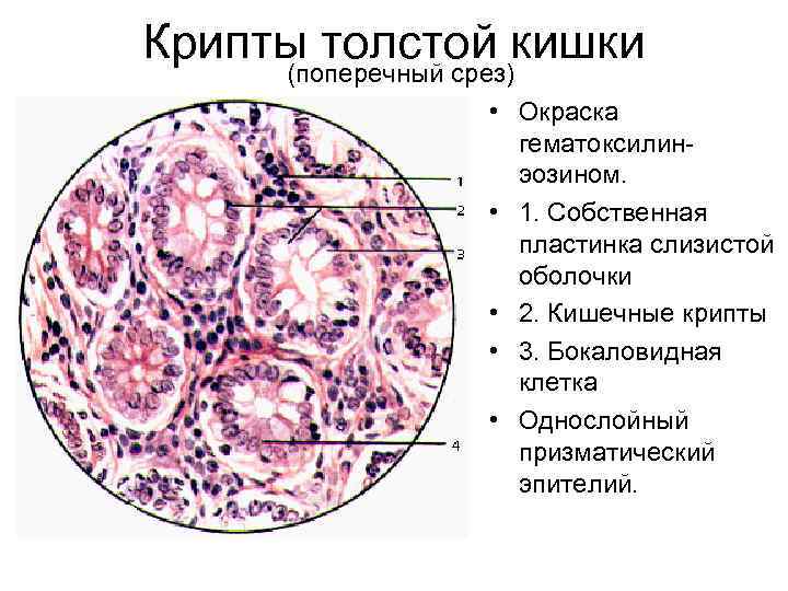 Крипты толстой кишки (поперечный срез) • Окраска гематоксилинэозином. • 1. Собственная пластинка слизистой оболочки