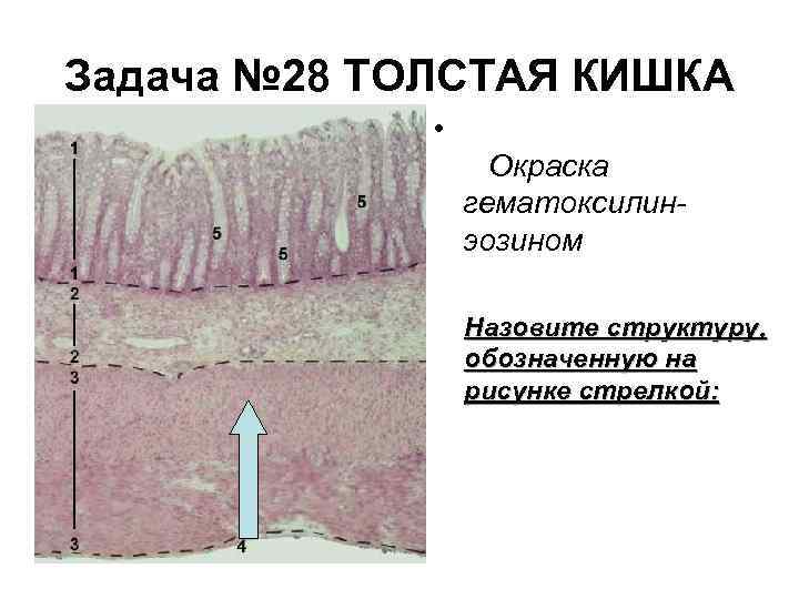 Задача № 28 ТОЛСТАЯ КИШКА • Окраска гематоксилинэозином Назовите структуру, обозначенную на рисунке стрелкой:
