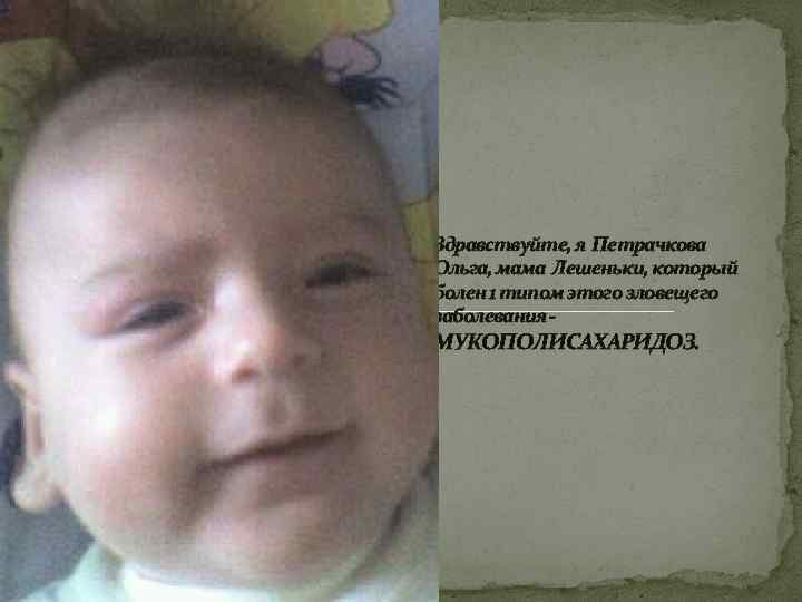 Здравствуйте, я Петрачкова Ольга, мама Лешеньки, который болен 1 типом этого зловещего заболевания -
