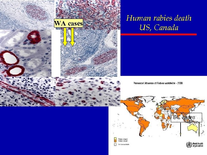 WA cases Human rabies death US, Canada BC cases 