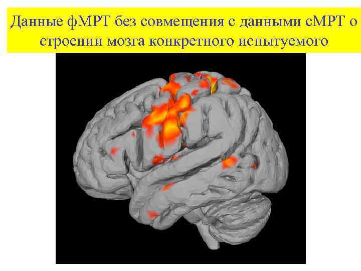 Данные ф. МРТ без совмещения с данными с. МРТ о строении мозга конкретного испытуемого