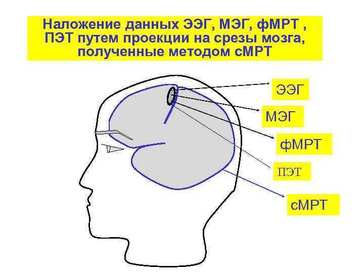 Наложение данных ЭЭГ, МЭГ, ф. МРТ , ПЭТ путем проекции на срезы мозга, полученные