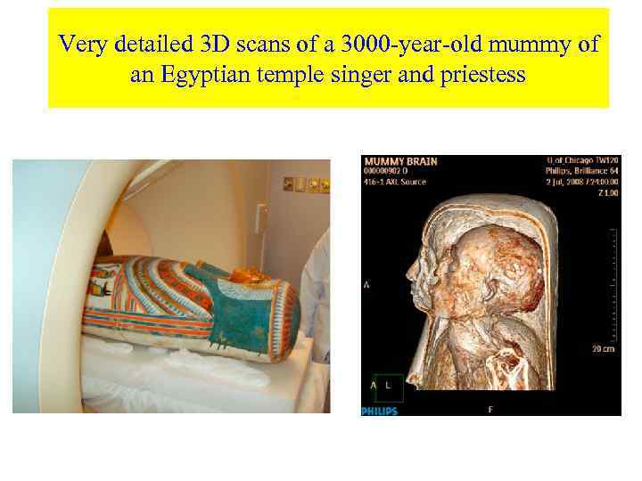 Very detailed 3 D scans of a 3000 -year-old mummy of an Egyptian temple