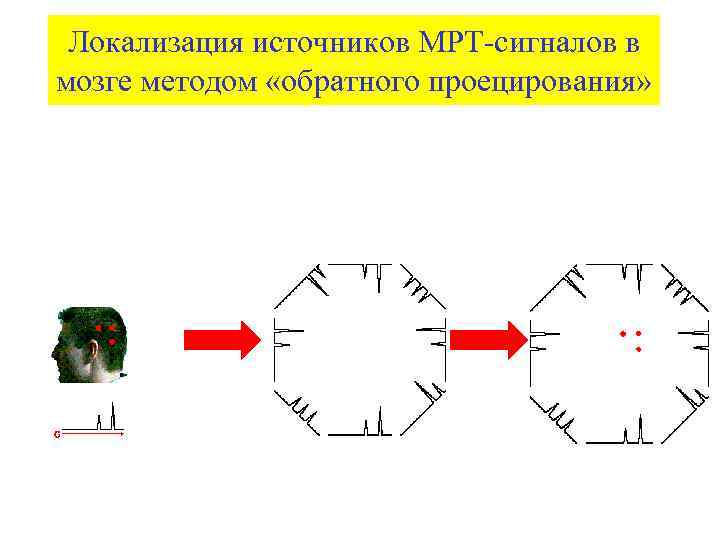 Локализация источников МРТ-сигналов в мозге методом «обратного проецирования» 