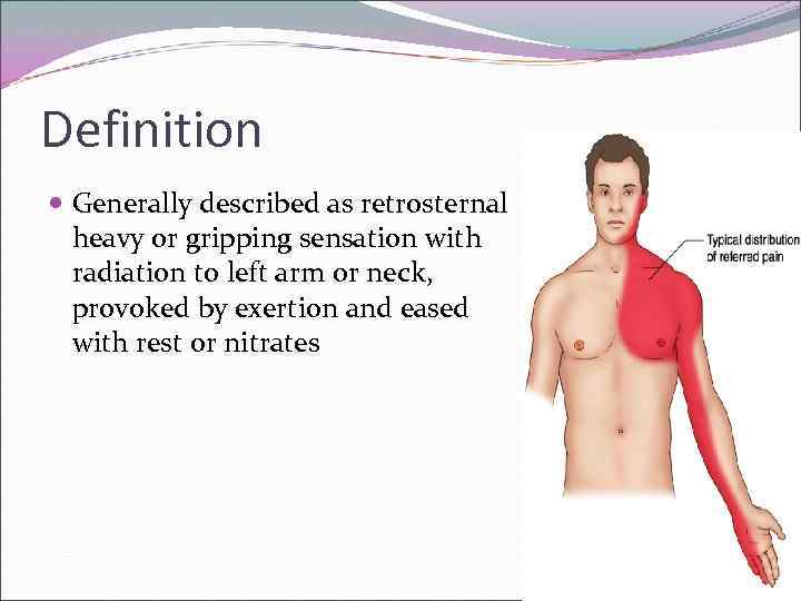 Definition Generally described as retrosternal heavy or gripping sensation with radiation to left arm