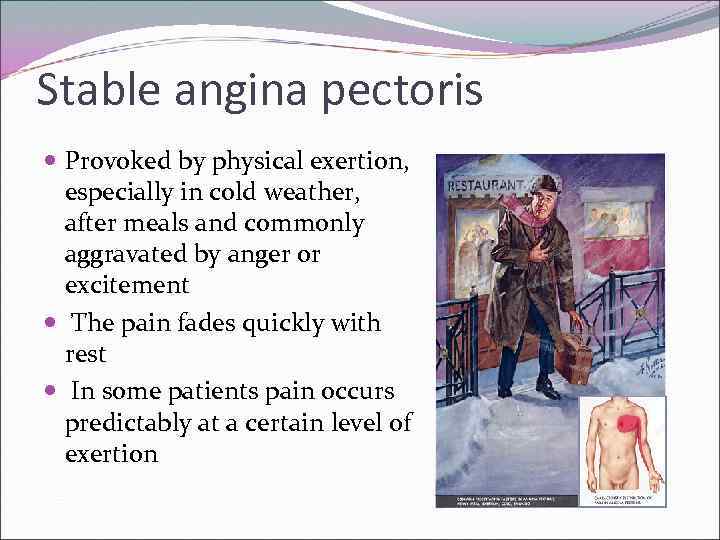 Stable angina pectoris Provoked by physical exertion, especially in cold weather, after meals and