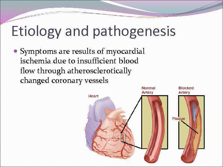 Etiology and pathogenesis Symptoms are results of myocardial ischemia due to insufficient blood flow