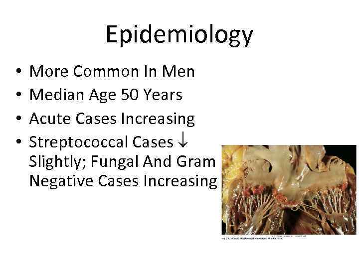 Epidemiology • • More Common In Median Age 50 Years Acute Cases Increasing Streptococcal