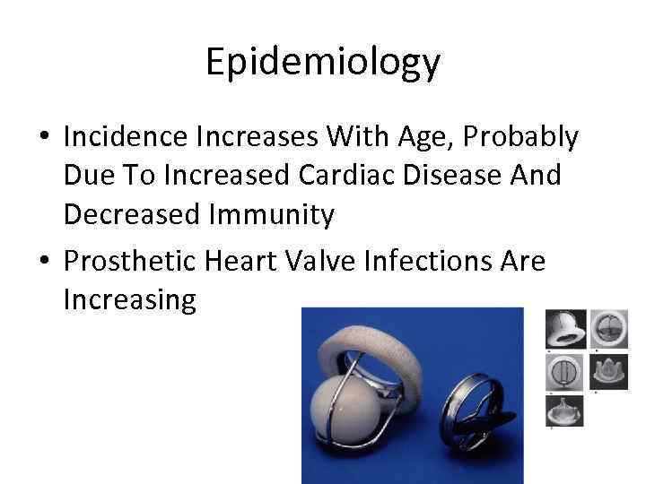 Epidemiology • Incidence Increases With Age, Probably Due To Increased Cardiac Disease And Decreased