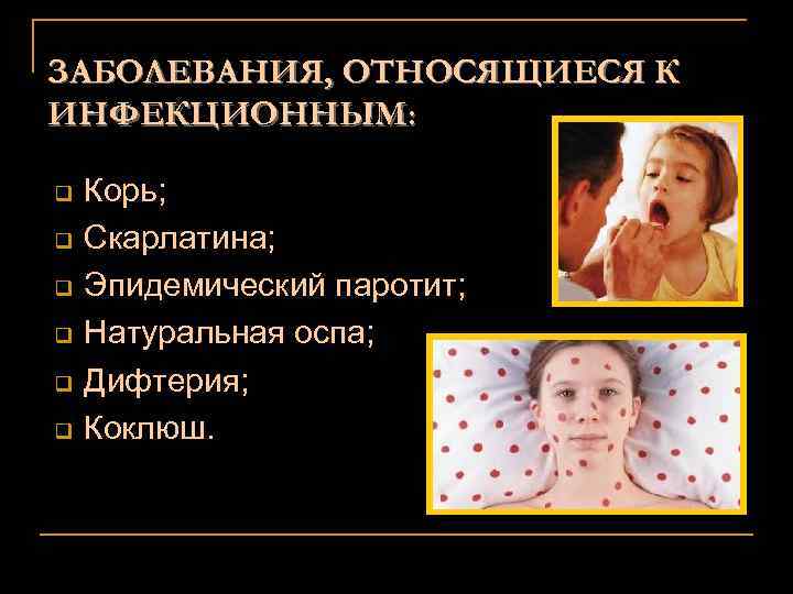 ЗАБОЛЕВАНИЯ, ОТНОСЯЩИЕСЯ К ИНФЕКЦИОННЫМ: q q q Корь; Скарлатина; Эпидемический паротит; Натуральная оспа; Дифтерия;