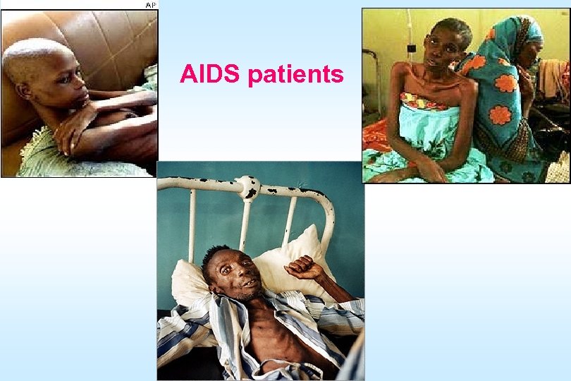 AIDS patients 