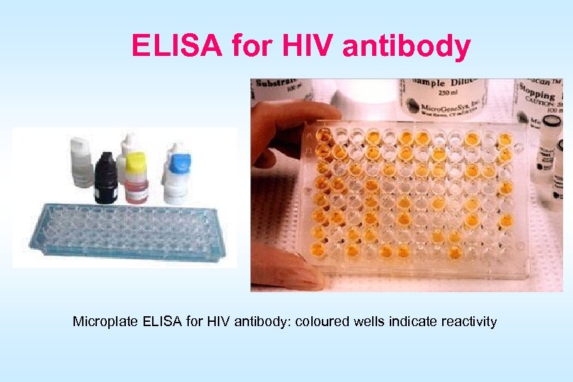 ELISA for HIV antibody Microplate ELISA for HIV antibody: coloured wells indicate reactivity 