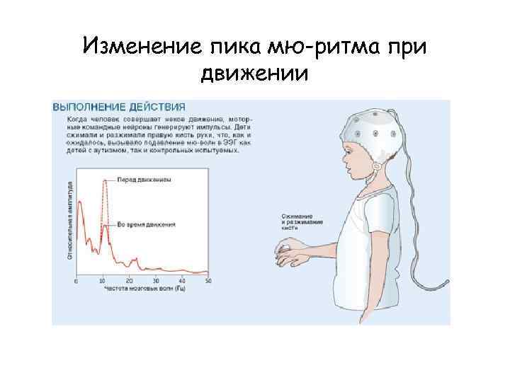 Изменение пика мю-ритма при движении 