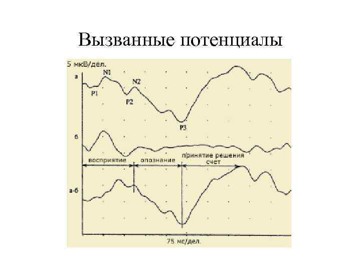 Моторные вызванные потенциалы