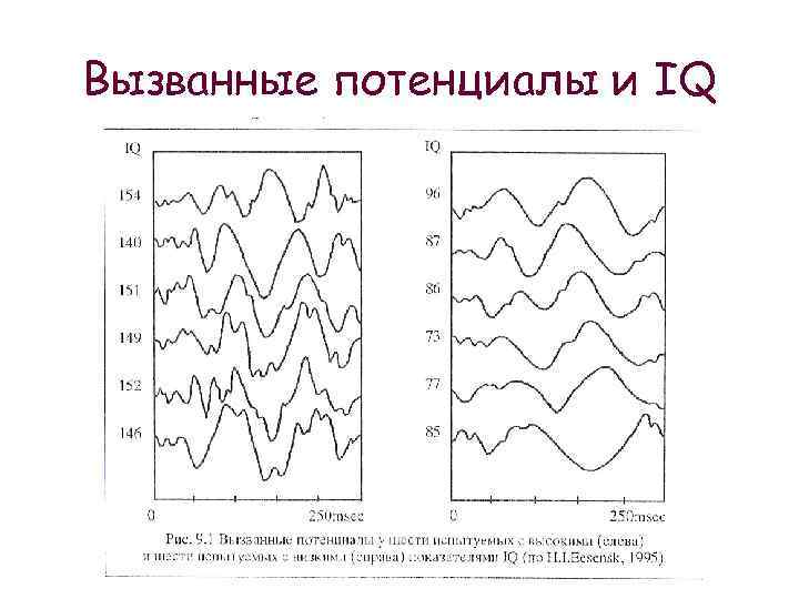 Моторные вызванные потенциалы