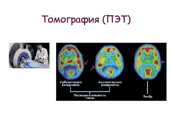 Томография (ПЭТ) 