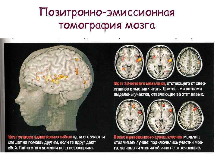 Сколько действует энцефалограмма головного мозга для медкомиссии на работу