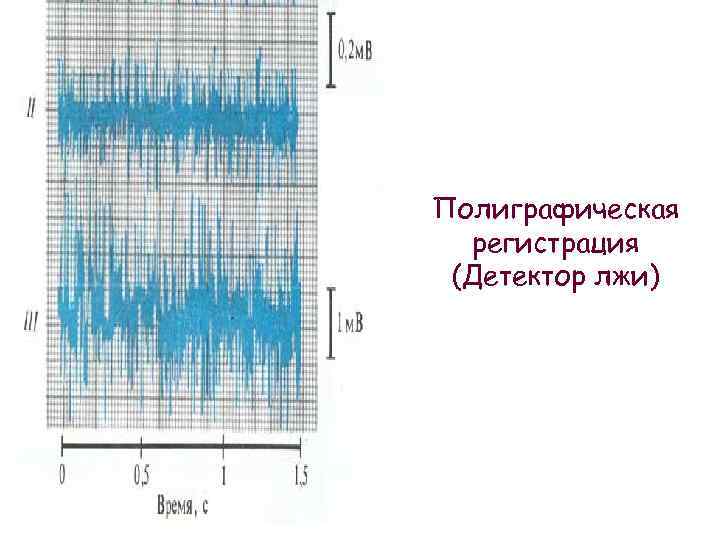 Полиграфическая регистрация (Детектор лжи) 