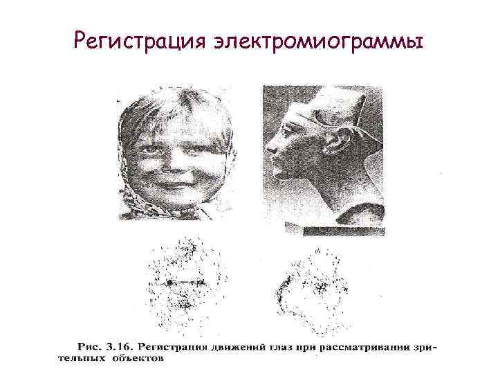 Регистрация электромиограммы 
