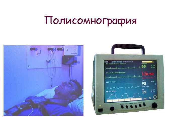 Эмг самара. Полисомнография. Стационарная полисомнография. Полисомнографическое исследование.